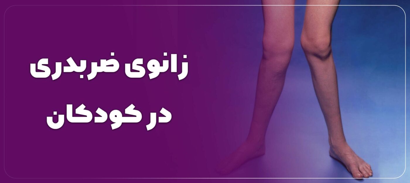 زانوی ضربدری در کودکان
