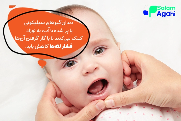 برای راحت‌تر دندان درآوردن نوزاد چه کار کنیم؟