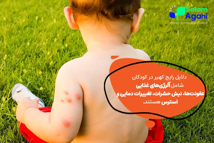 انواع کهیر در کودکان و درمان آن