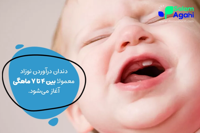 زمان دندان درآوردن نوزاد از چند ماهگی است؟