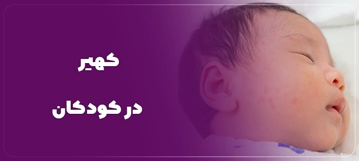 درمان قطعی کهیر کودکان