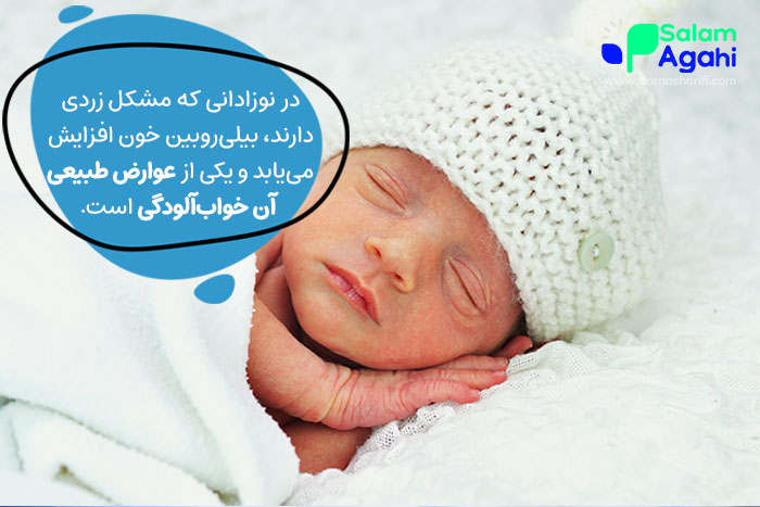 زردی، علت زیاد خوابیدن نوزاد نارس